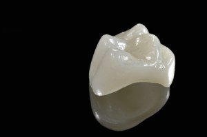 replacement dental crowns can be an option when there is significant damage