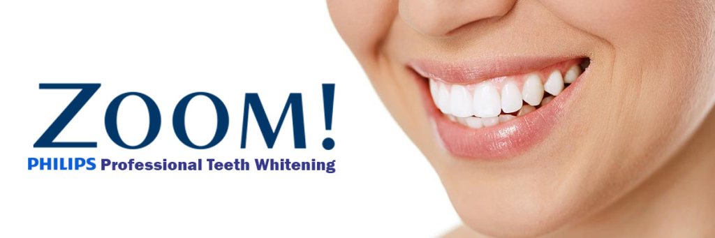 Zoom! Whitening can produce pleasant results