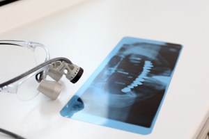 x-ray imaging can be used in diagnosis and treatment planning