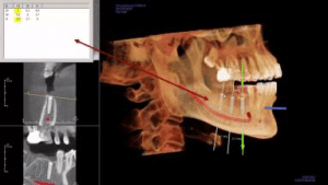 CT scan of lower skull can help with planning treatment