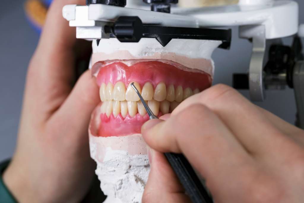 dentures in wax in the middle of fabrication on an articulator