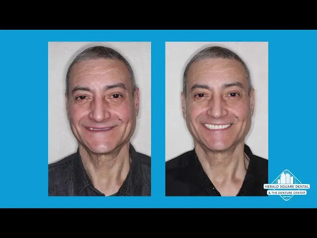 Are Dentures Right For Me? Video Thumbnail